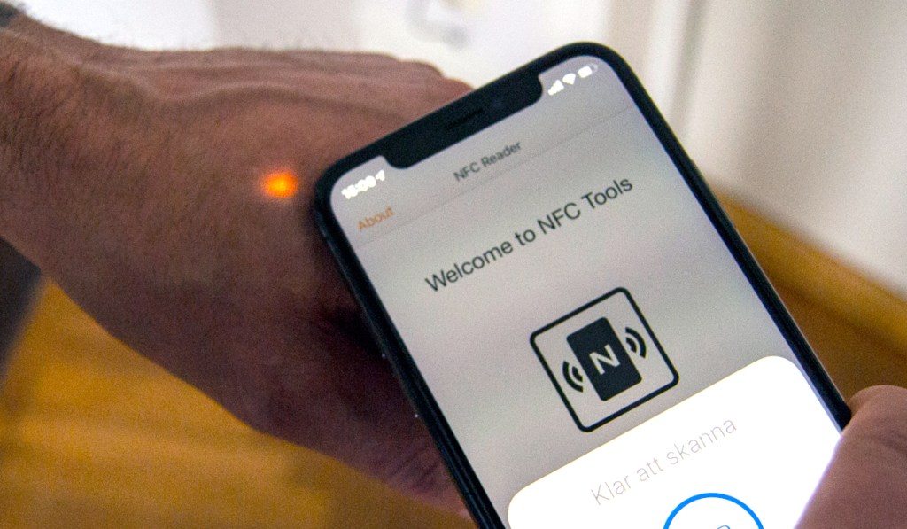 Vivir con un chip bajo la&nbsp;piel